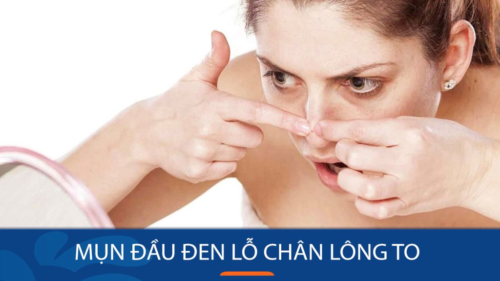 8 Cách Triệt Phá Mụn Đầu Đen & Se Khít Lỗ Chân Lông TO Tự Nhiên – Bí Quyết Da Mịn Màng Không Tì Vết