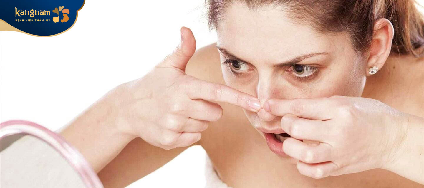 Nặn mụn cũng khiến mụn đầu đen phát triển nghiêm trọng hơn