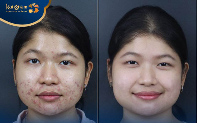 Nên thăm khám với bác sĩ sớm để được điều trị