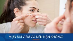 Mụn mủ viêm có nên nặn không? Cách nặn mụn mủ viêm đúng chuẩn trong 3 bước đơn giản