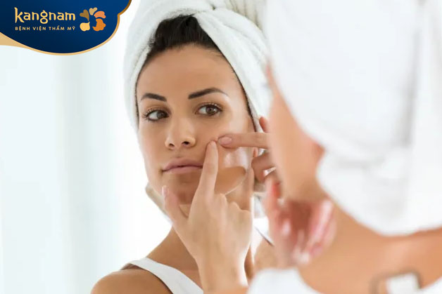 Không nên tự ý nặn mụn nang tại nhà