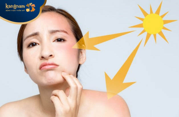 Tác động từ ánh nắng mặt trời có thể làm hình thành mụn mủ