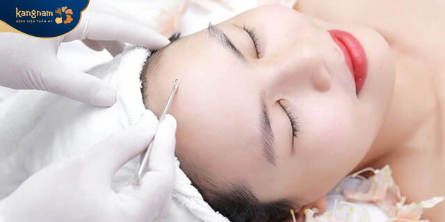 Bạn nên đến các địa chỉ thẩm mỹ uy tín để được nặn mụn chuẩn y khoa