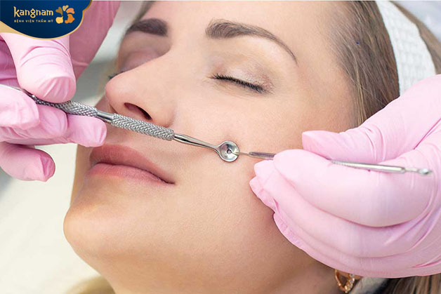 Tuyệt đối không dùng kim để chích mụn không nhân