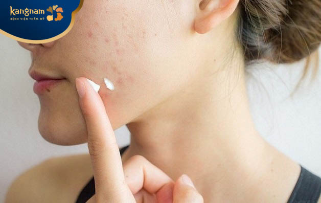 Sử dụng thuốc bôi ngoài da