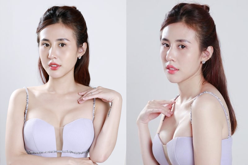 Nhan sắc của Phương Anh sau beauty Up