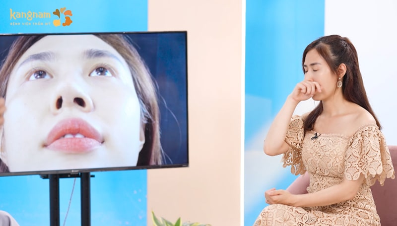 Phương Anh beauty Up mũi lệch