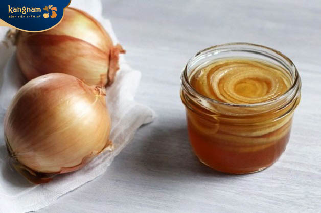Trị sẹo lồi bằng hành tây và mật ong