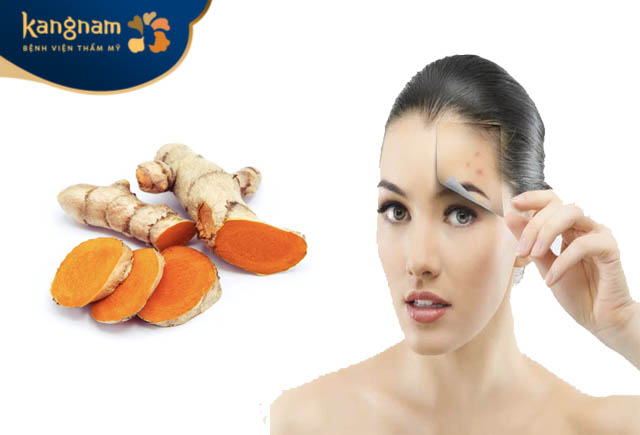 Dùng nghệ tươi loại bỏ sẹo rỗ thâm