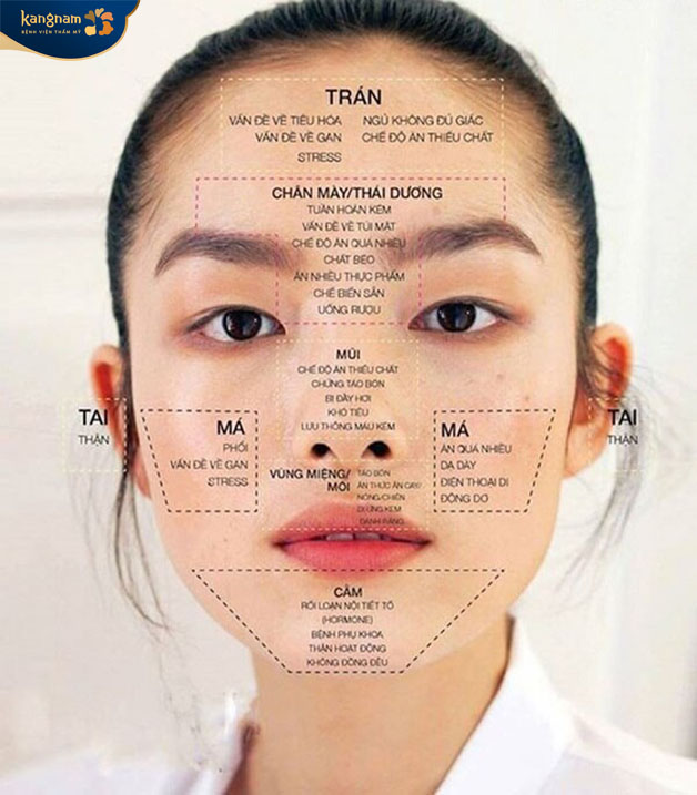 Mỗi một ví trí nổi mụn báo hiệu một vấn đề trong cơ thể