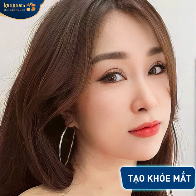 Chị khách đẹp xuất thần sau khi cắt mí