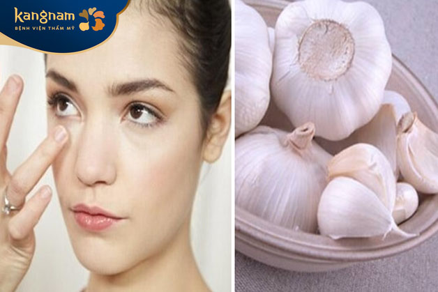 Thoa tỏi giúp mụn gom cồi nhanh