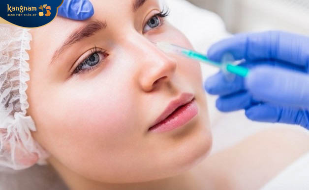 Filler tự tan được không