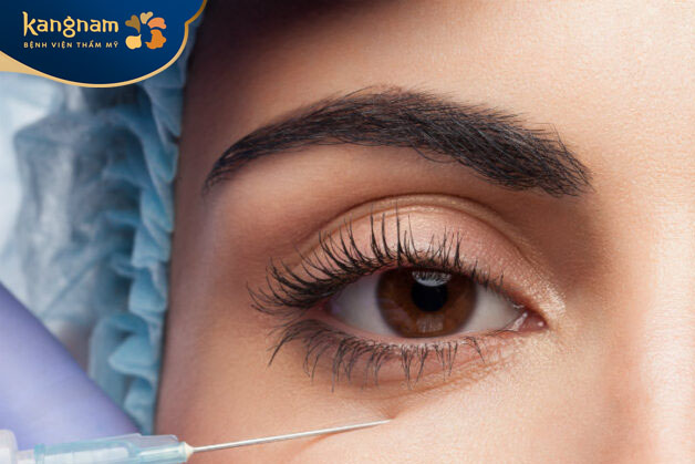 Tiêm chất làm đầy hốc mắt không gây nguy hiểm