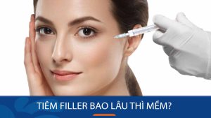 Tiêm filler má bao lâu thì mềm? một số lưu ý quan trọng