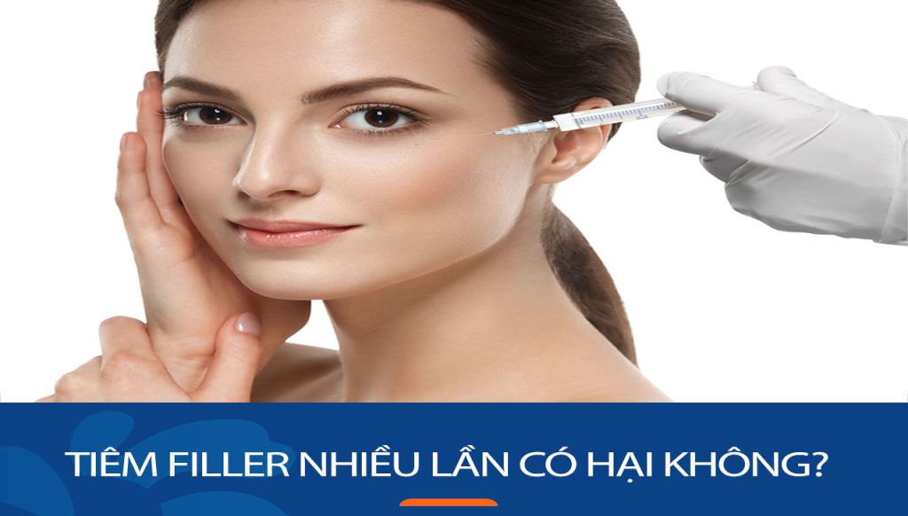 Tiêm filler nhiều lần có hại không? Một số điểm cần lưu ý