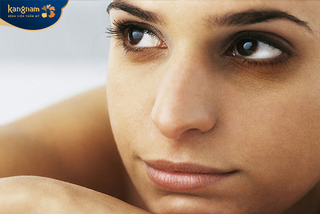 Vấn đề tuổi tác là một trong những nguyên nhân chính khiến quầng thâm xuất hiện