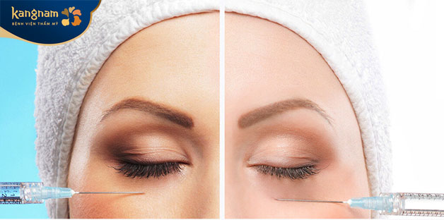 Không chỉ quầng thâm mà hốc mắt trũng sâu cũng biến mất