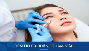Tiêm filler quầng thâm mắt: Giải pháp hoàn hảo cho đôi mắt sáng
