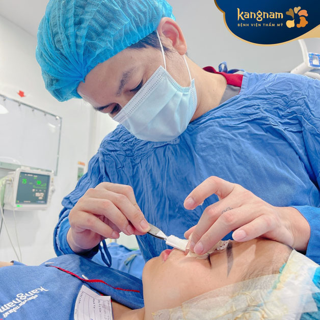 Quy trình cắt cánh mũi