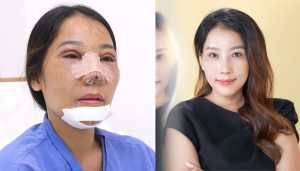 U40 “trốn chồng” đi thẩm mỹ và cái kết