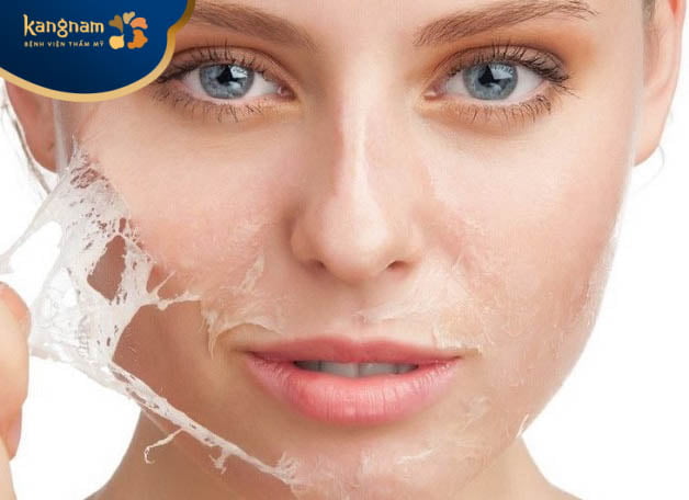 Bong tróc sau thực hiện peel da
