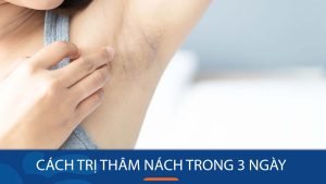 11 Cách trị thâm nách trong 3 ngày cấp tốc