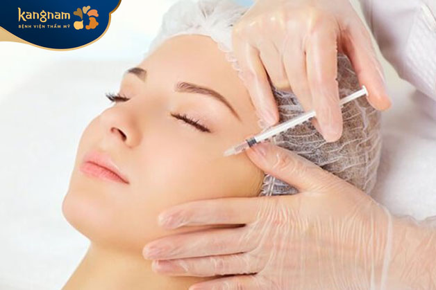 quá trình cấy Meso Extra có khả năng duy trì từ 6 tháng đến 1 năm