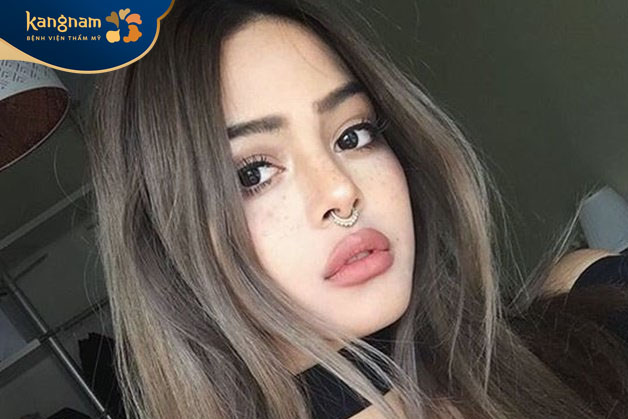 Tiêm môi tây giúp môi căng mọng, quyến rũ