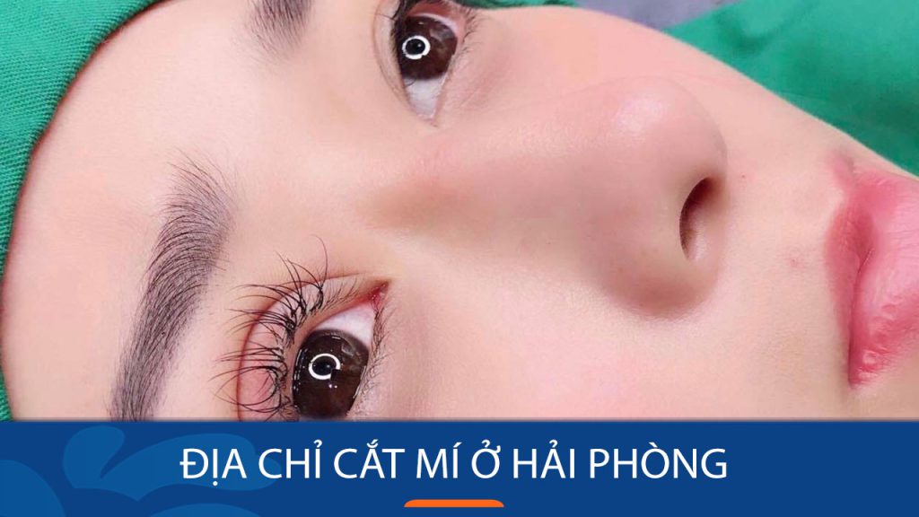 cắt mí kangnam Hải Phòng? Gợi ý 6 địa chỉ uy tín