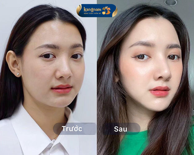 Gương mặt thanh thoát, sắc sảo hơn rất nhiều