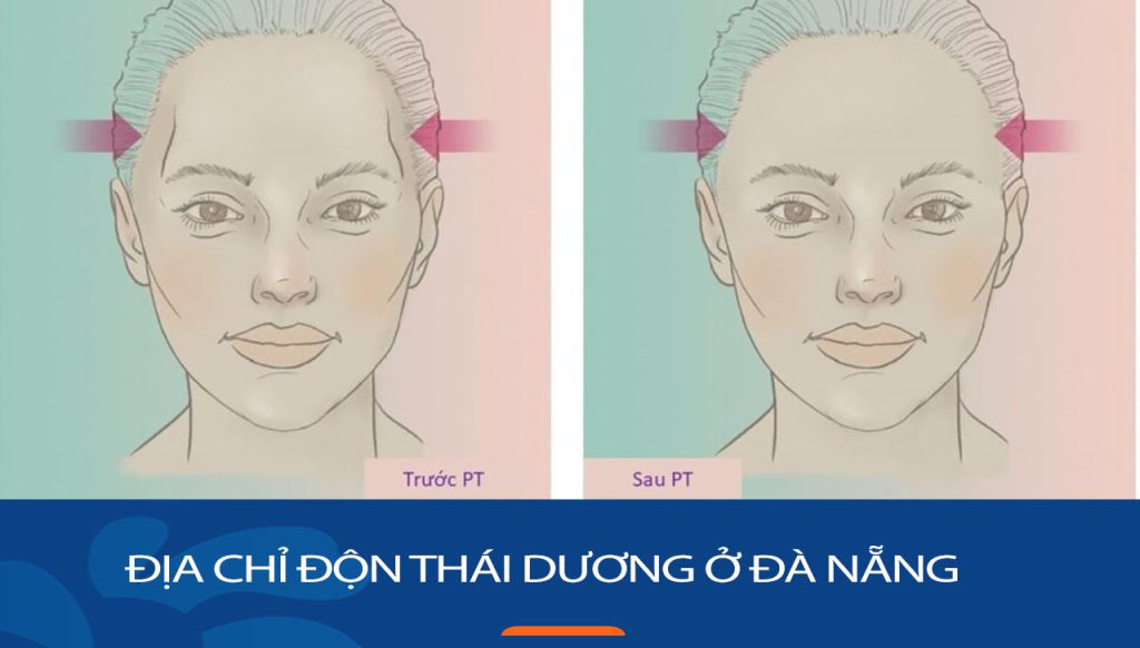 Địa chỉ độn thái dương kangnam Đà Nẵng