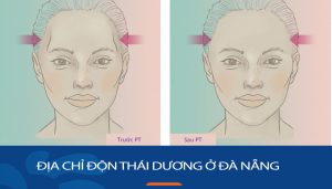 Địa chỉ độn thái dương kangnam Đà Nẵng