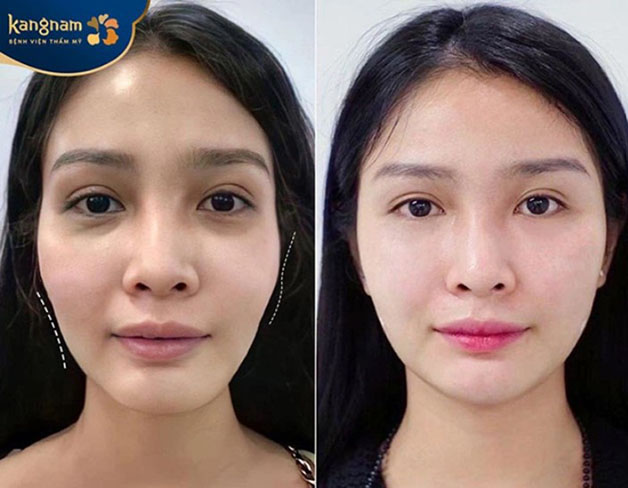 Diện mạo mới giúp khách hàng tự tin hơn hẳn 