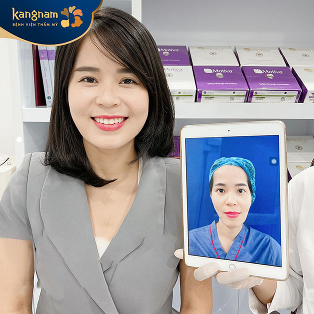 Khuôn mặt khách hàng cân đối, đầy đặn hơn sau khi độn thái dương