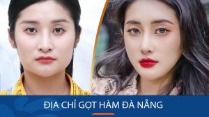 Gọt hàm kangnam Đà Nẵng