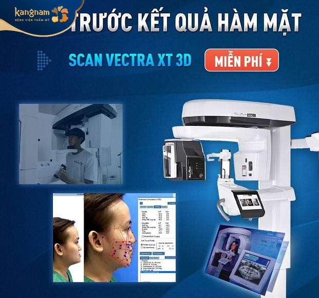 Ứng dụng Vectra XT 3D mô phỏng kết quả trước khi gọt hàm