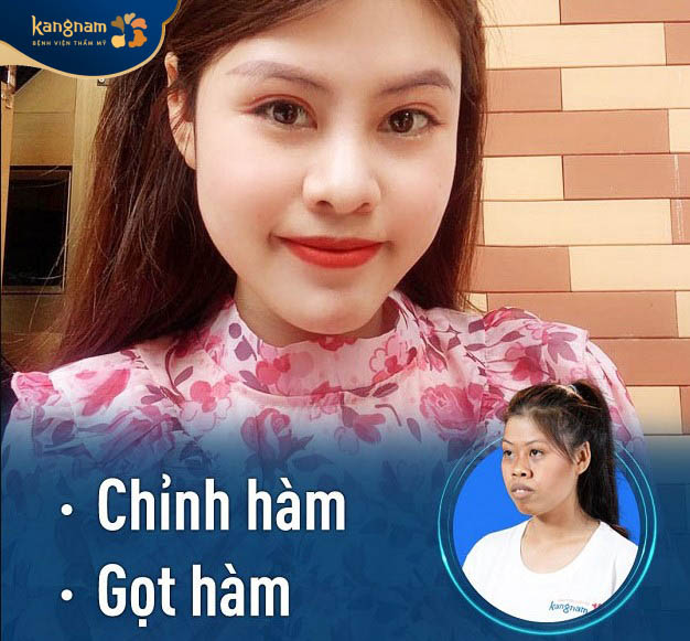 Quy trình phẫu thuật an toàn, chuẩn y khoa