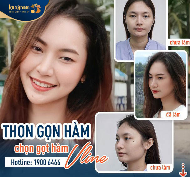 Dịch vụ bảo hành tại Kangnam uy tín