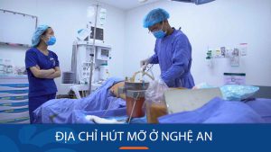 Hút Mỡ Tại Kangnam Nghệ An: Địa Chỉ Uy Tín, Công Nghệ Tiên Tiến, Đạt Chuẩn Y Tế