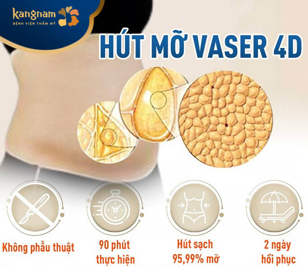 Công nghệ hút mỡ Vaser 4D