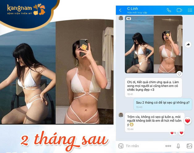 Chị Hiền - Khách hàng hút mỡ tại Kangnam nhắn tin feedback