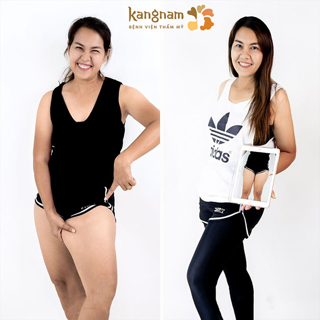 Tạm biệt đùi ếch chỉ sau 45 phút thực hiện 