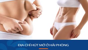 Địa chỉ Hút mỡ kangnam Hải Phòng an toàn, uy tín nhất, hiệu quả