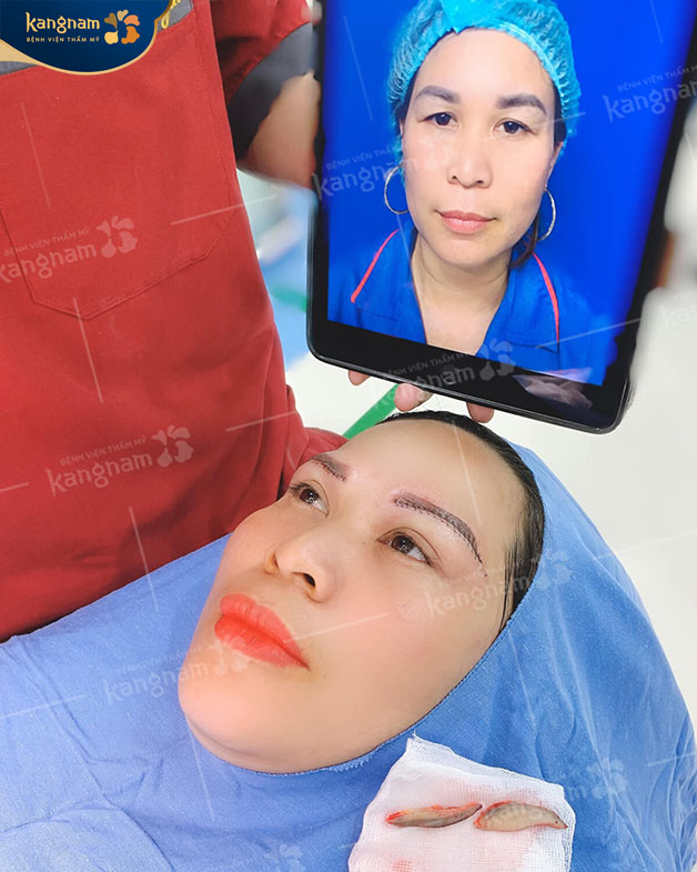 Không để lại sẹo, đảm bảo tính thẩm mỹ