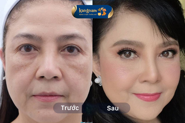 Cô Thu vui mừng, tự tin hơn sau khi thực hiện dịch vụ