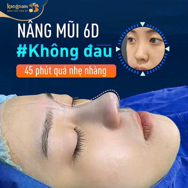 Sống mũi cao, hài hòa với khuôn mặt 