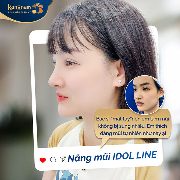 Bạn Ngọc Linh hài lòng sau khi nâng mũi Idol Line