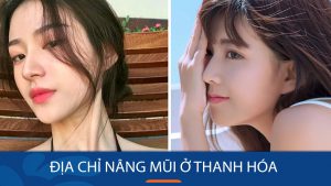 Địa chỉ nâng mũi kangnam Thanh Hóa chuẩn Hàn Quốc!