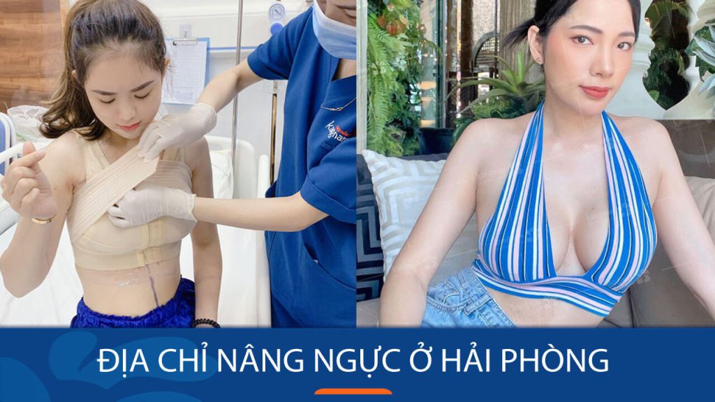 Địa chỉ nâng ngực tại Hải Phòng Đất Cảng Uy Tín, An toàn